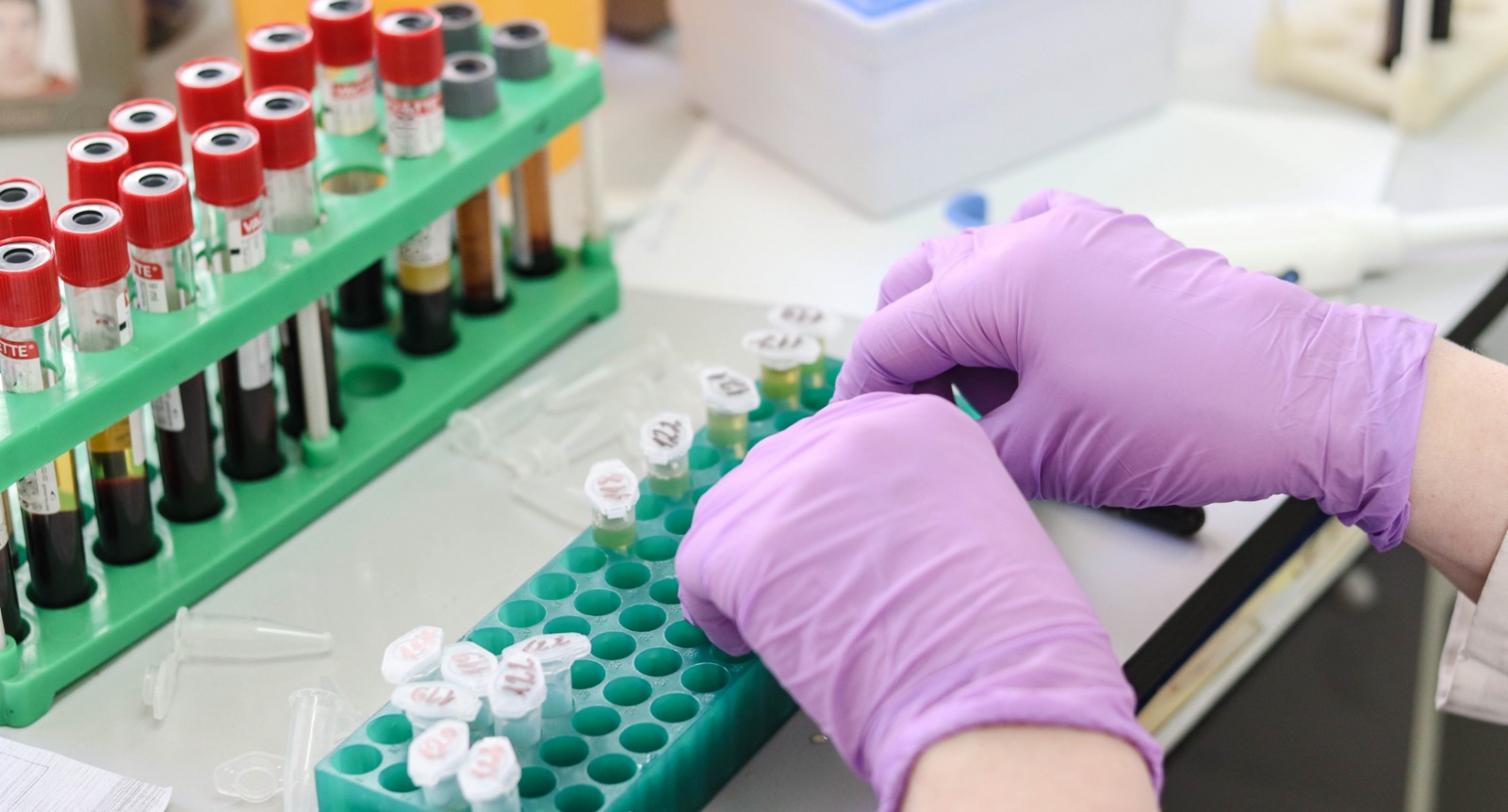 BS Medical Laboratory Technology
